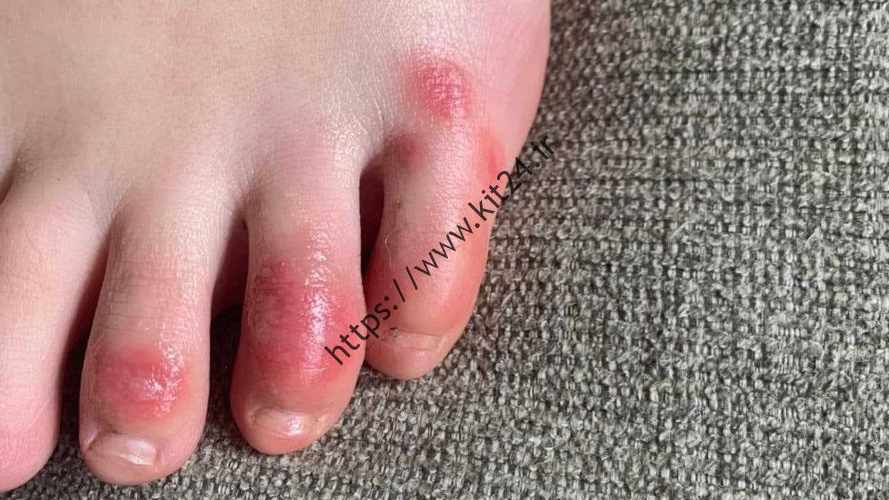 شش برند پوست Omicron که نباید نادیده گرفته شوند